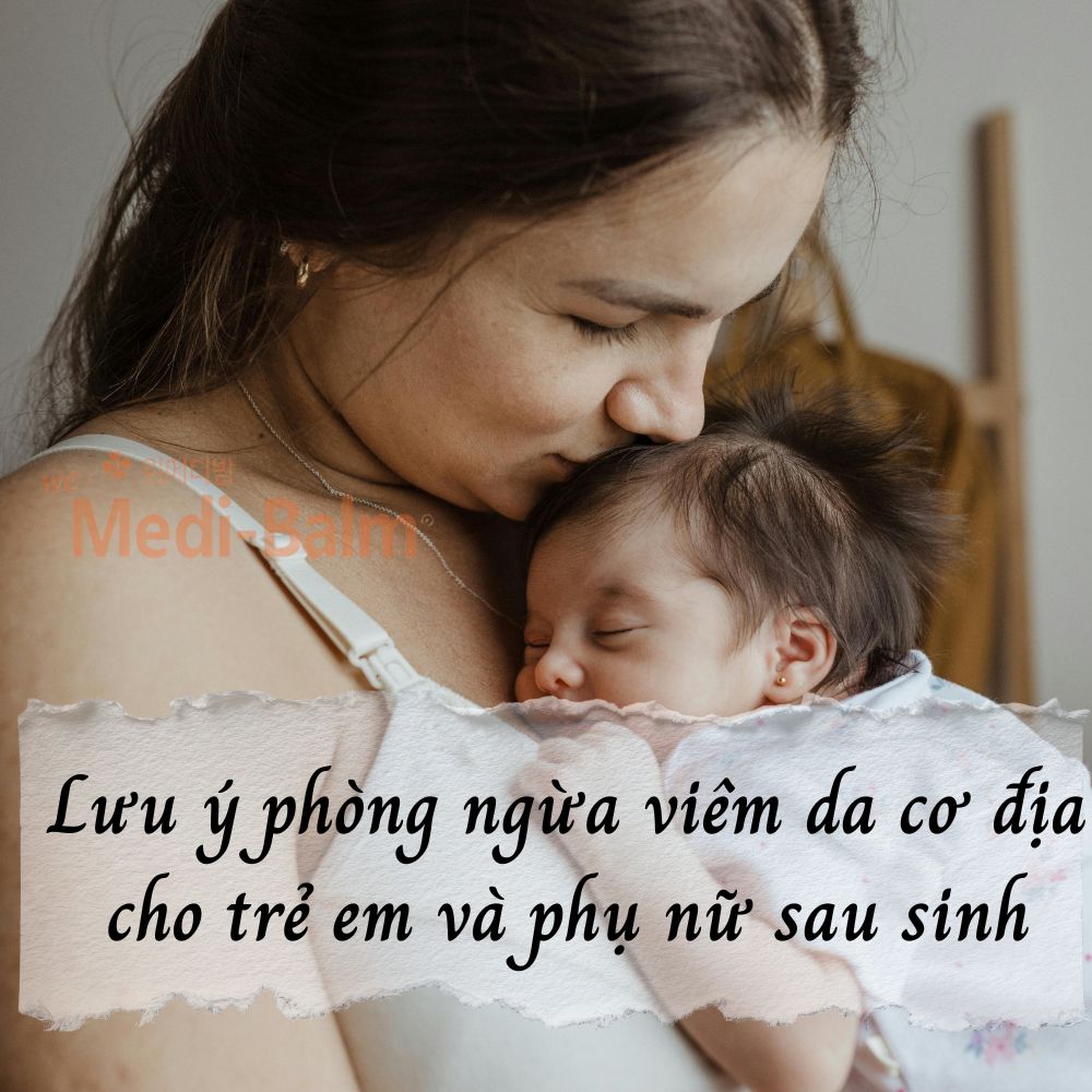 Cách phòng ngừa viêm da cơ địa