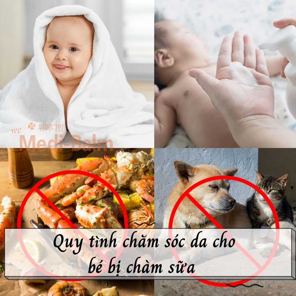 Quy trình chăm sóc da cho bé bị chàm sữa