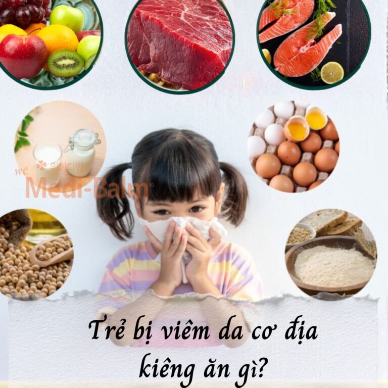Trẻ bị viêm da cơ địa kiêng ăn gì